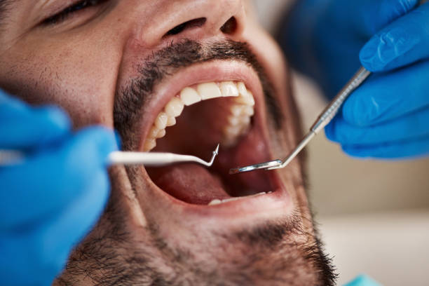 Best Emergency Dentist for Knocked-Out Tooth in Alba, NY