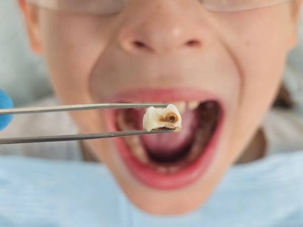 Best Urgent Dental Care for Toothache in Alba, NY